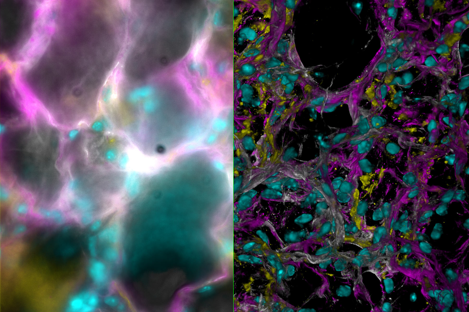 小鼠肺组织 AT1 生物学研究图像；黄色：GFP 谱系示踪，紫色：RAGE，青色：AQP5，灰色：DAPI。图像由 Yana Kazadaeva 提供。